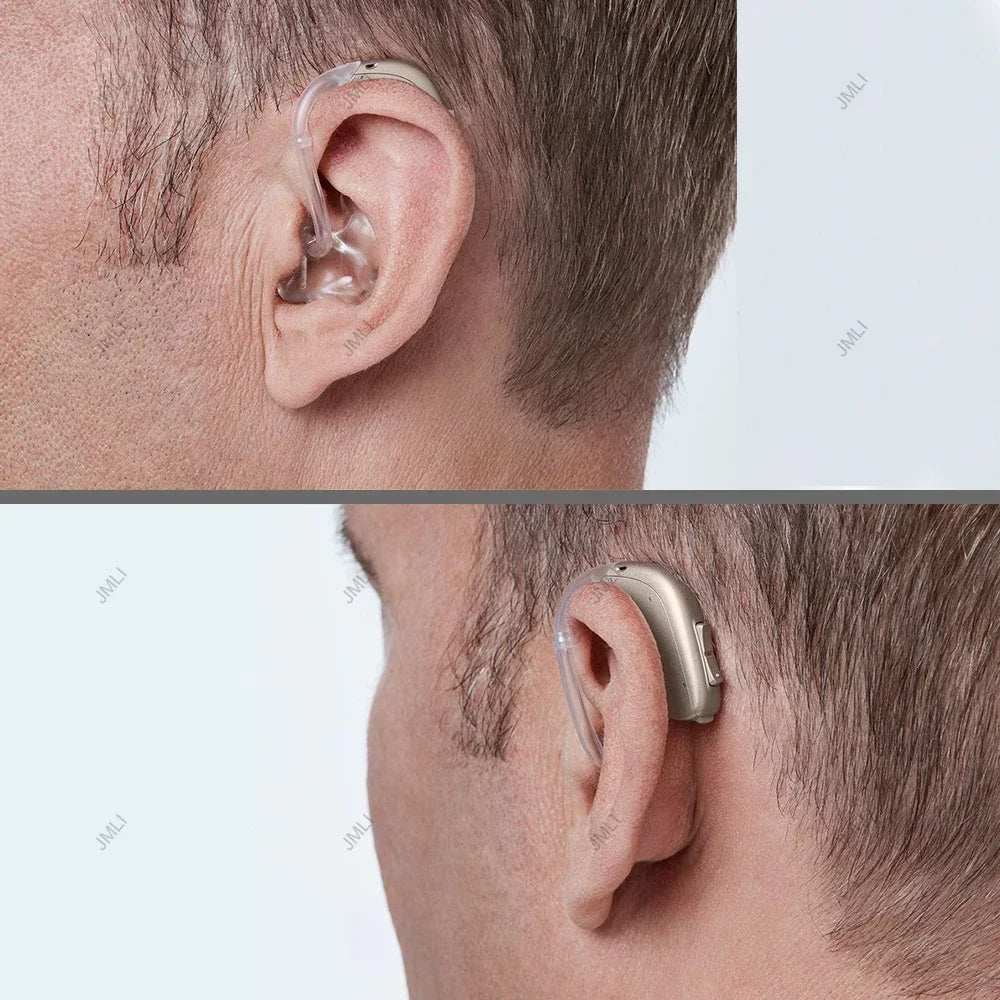 Oticon Jet 2 BTE Hearing Aid – 48 Channel