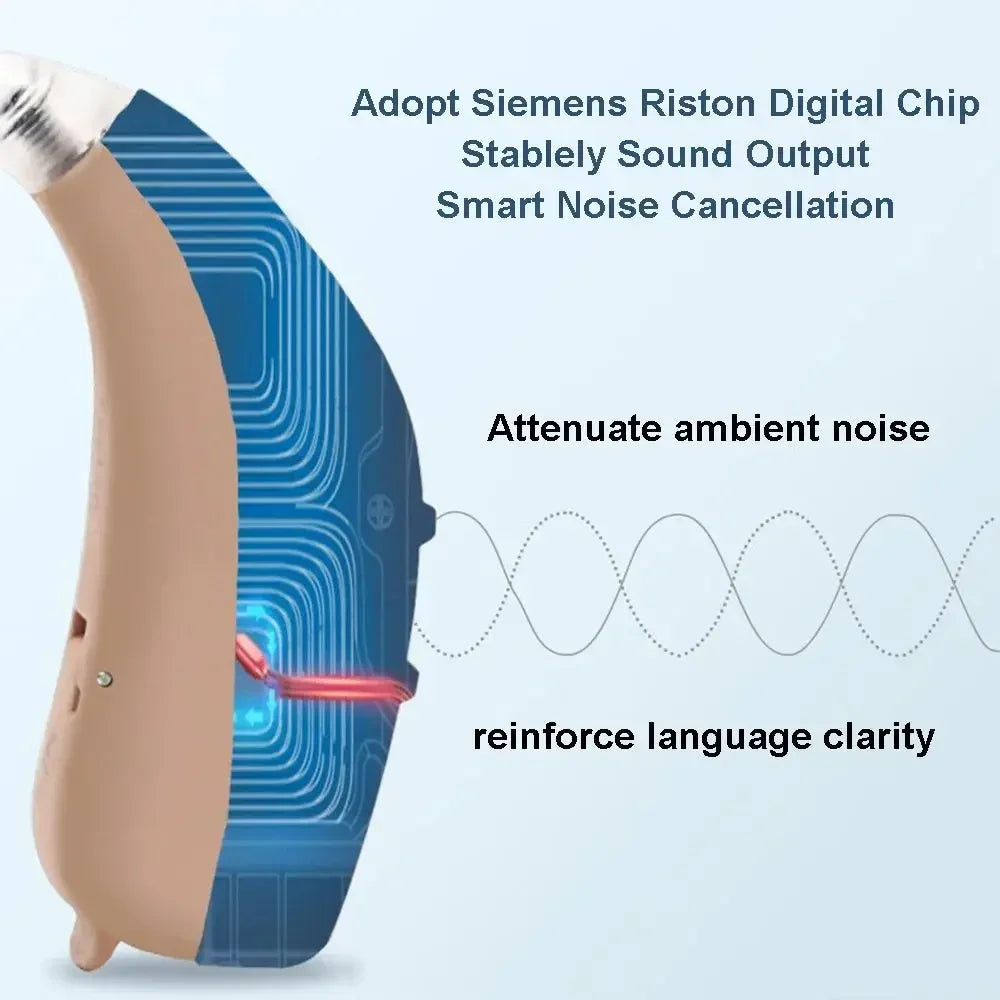 Rexton Targa Hearing Aid – App Programmable