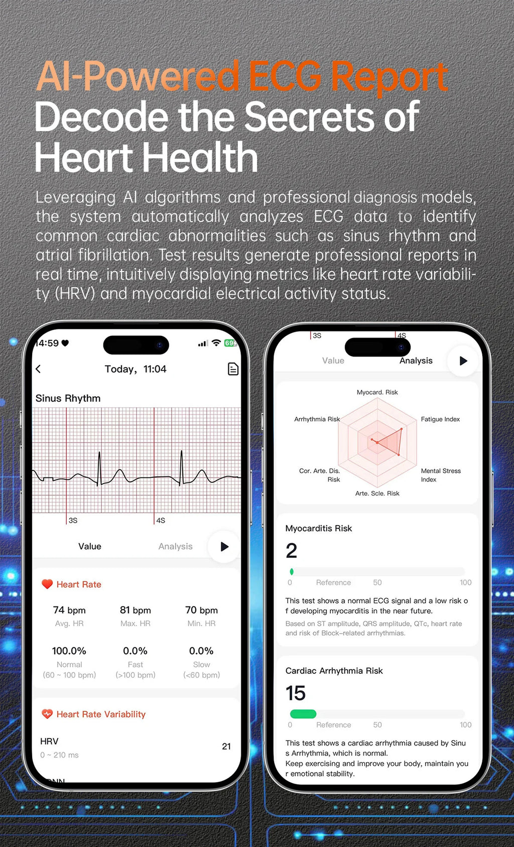 XIAOMI Smart Health Watch 1.56 AMOLED NFC