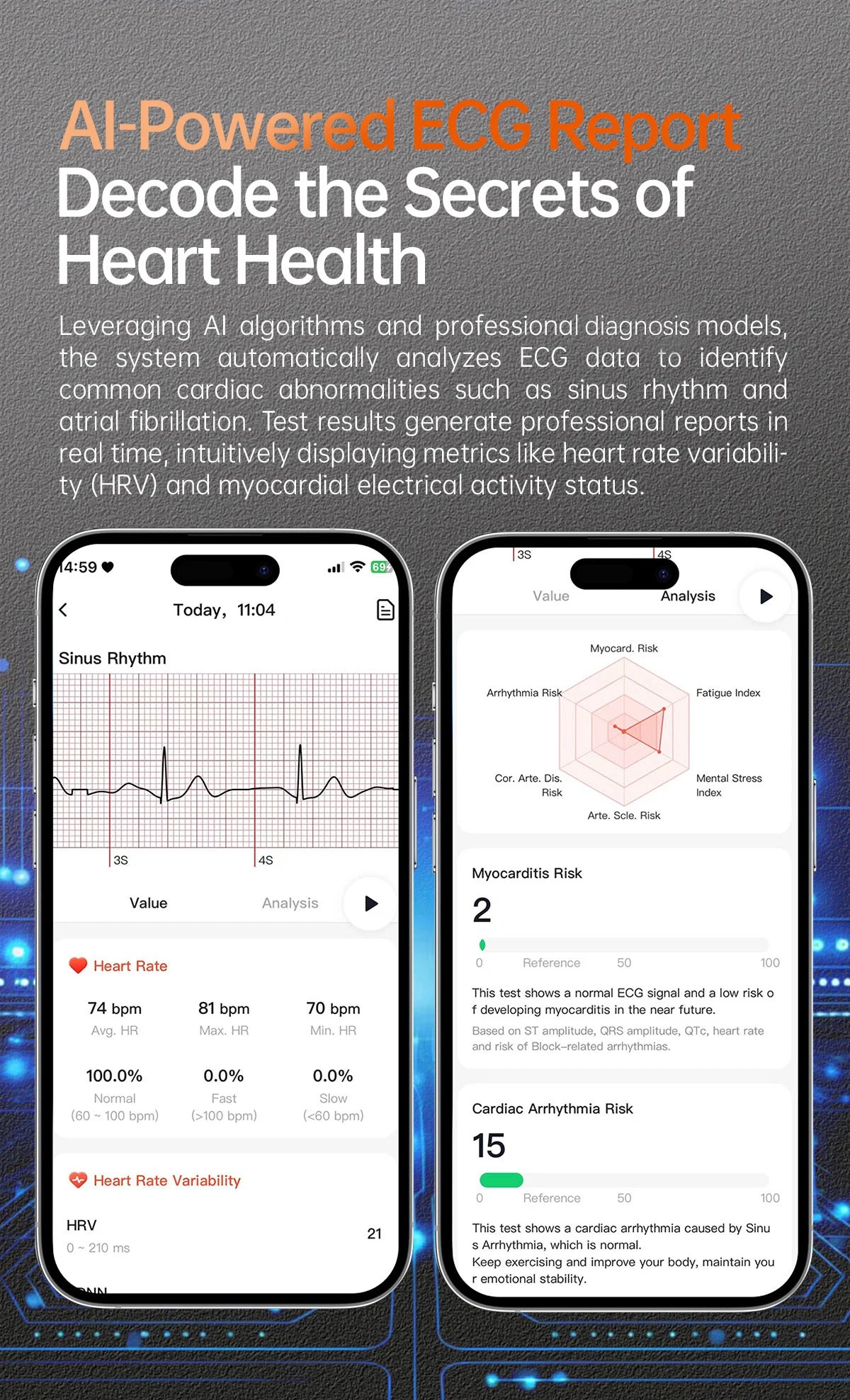 XIAOMI Smart Health Watch 1.56 AMOLED NFC