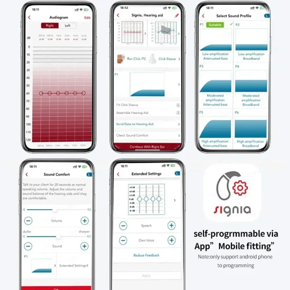 Signia Invisible Hearing Aid – CIC/ITC Programmable